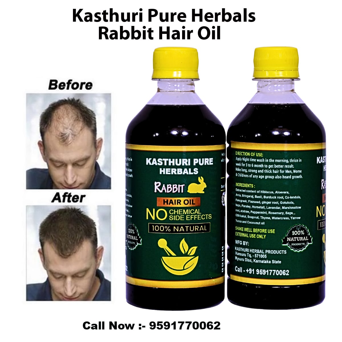 Kasthuri Pure Herbals Rabbit Hair Oil – Single Pack 500ml